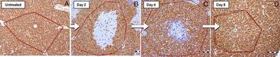 Figure 1. Mouse liver lobules visualized under light microscopy. (A) Control, (B) $t = 2\ \mathrm{d}$, (C) $t = 4\ \mathrm{d}$, and (D) $t = 8\ \mathrm{d}$ after administration of CCl4. ([©](https://www.pnas.org/about/rights-permissions) [**Höhme _et al._**](#reference), [Fig. 2A-D](https://www.pnas.org/doi/full/10.1073/pnas.0909374107#F2))